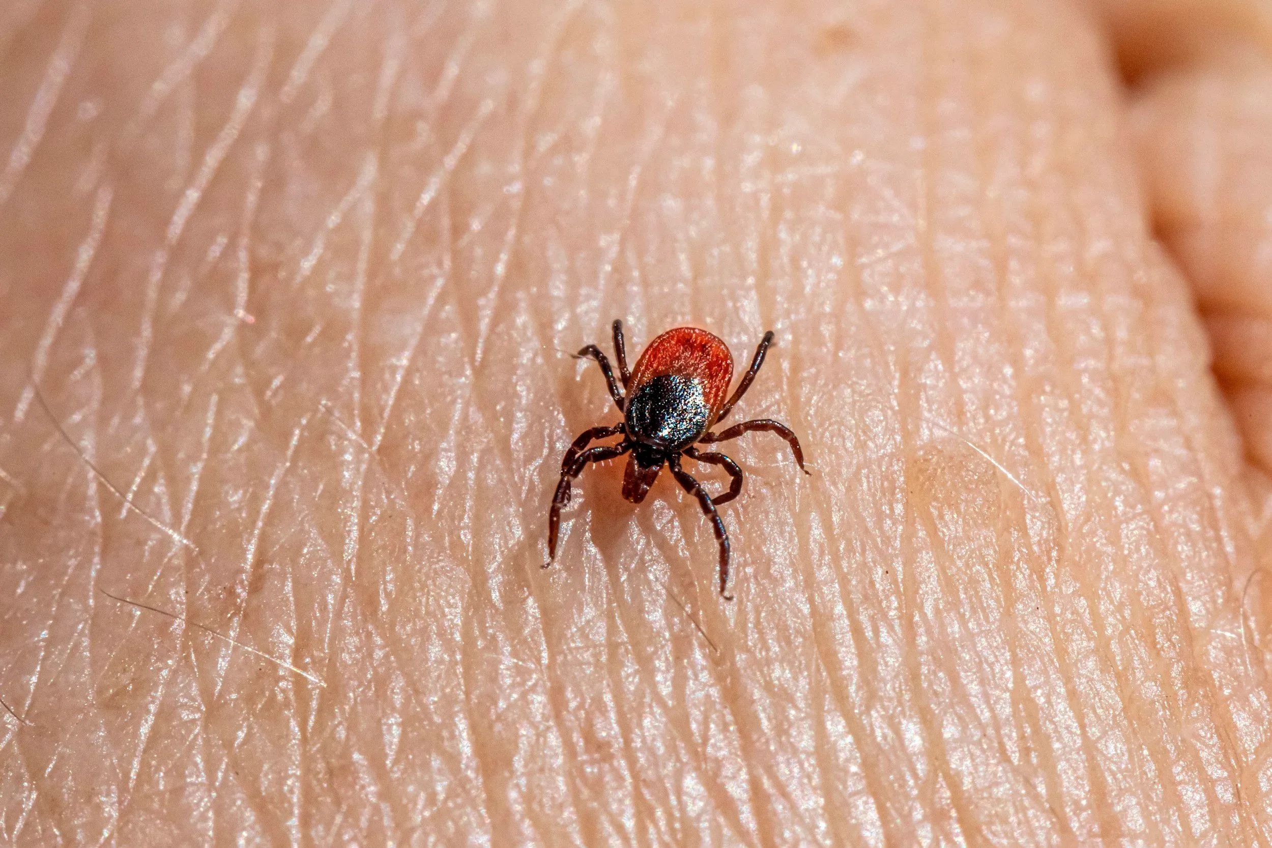Ticks